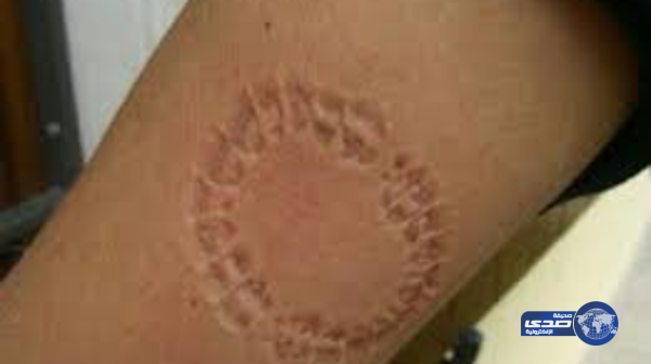 السجن لشاب “عض” شرطيا للتملص من مخالفة مرورية