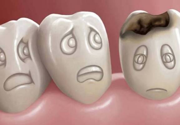 ما هي الفاكهة التي تقضي نهائياً على تسوس الأسنان؟