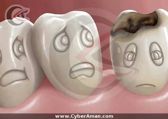 ما هي الفاكهة التي تقضي نهائياً على تسوس الأسنان؟