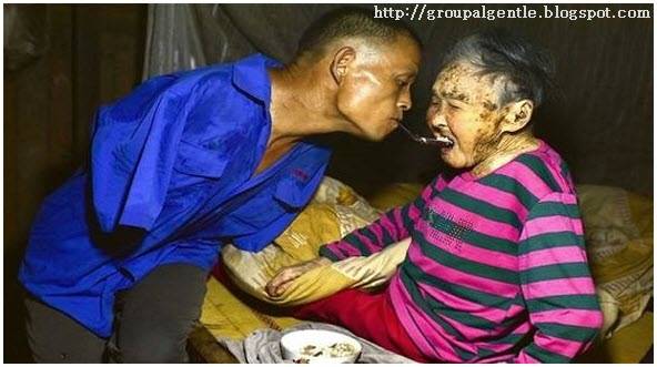 صورة:صيني مبتور الذراعين يطعم والدته المريضة بفمه