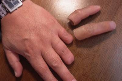 قطعت أصابع زوجها والسبب لا يصدق...! صورة