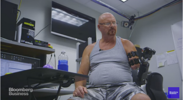 العلماء يكشفون عن يد اصطناعية تخضع لأوامر الدماغ