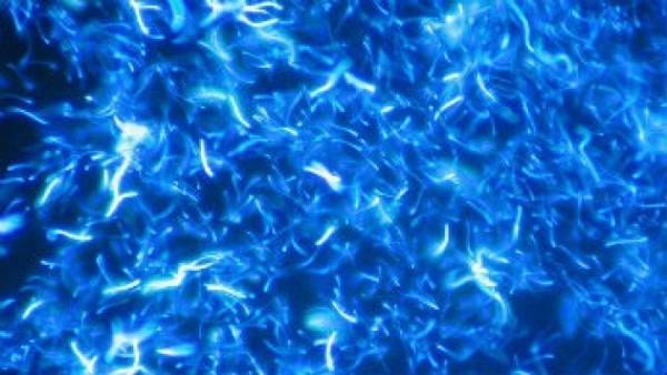 فرنسا توافق على نقل السائل المنوي من شخص متوفى إلى أرملته في إسبانيا