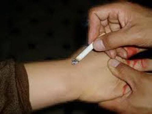 جنود الاحتلال أطفأووا سجائرهم بجسد الأسير طقاطقة