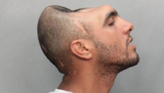 وصية رجل يعيش بنصف رأس بسبب حادث سير