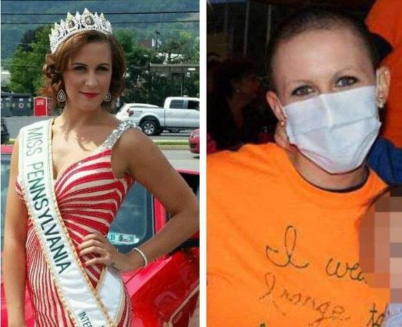 لا يُصدّق .. سجن ملكة جمال ولاية بنسلفانيا لزعمها الإصابة بالسرطان