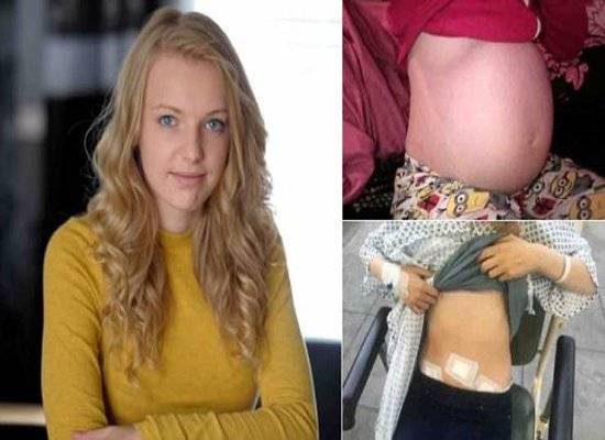 صور .. استمر بطنها في الانتفاخ حتى أصبح بحجم كرة السلة.. والسبب!!