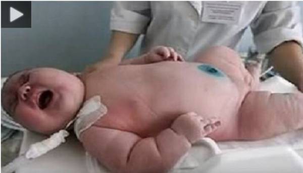 فيديو... ولادة أضخم رضيع في العالم