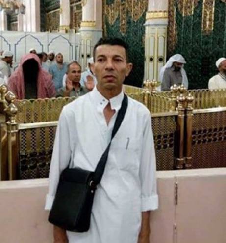 للقلوب القوية فقط.. ما حقيقة صورة رجل ممسوح الوجه بالمسجد النبوي!! صورة