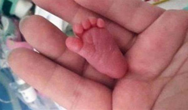 بالصور .. أصغر رضيعة في العالم وزنها لم يتعد وزن حبة من الفلفل