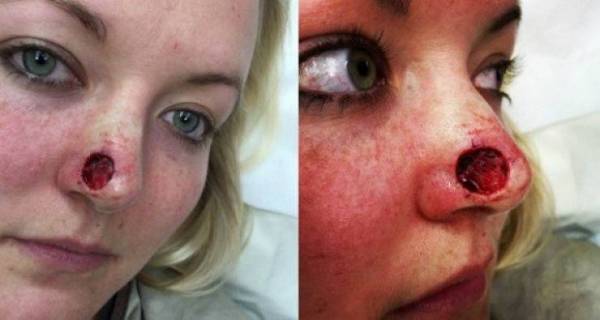 صور... امرأة مدمنة على عادة غريبة قلبت حياتها رأسا على عقب..ما هي؟