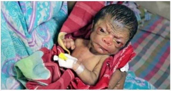 بالفيديو +18.. طفل ولد من بطن أمه وهو في الثمانين من عمره يرعب العالم!