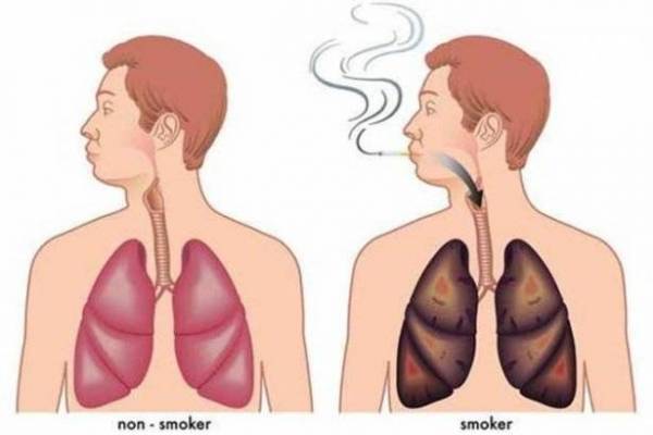 مشروب طبيعي يطهّر الرئتين من آثار التدخين
