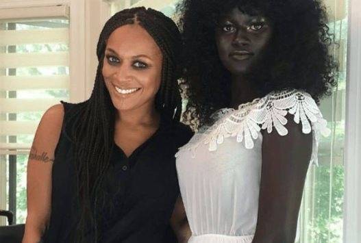 سينغالية تجتاح صورها الإنترنت لسواد بشرتها النادر (صور)