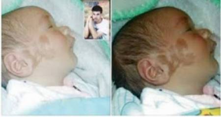 طفل وُلد مكتوباً على خده اسم علاء.. ماذا اجابت الأم حين سُئلت عن صاحب الاسم!!