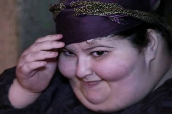 آية: طفلة بعمر 11 عاماً وزنها 200 كيلو