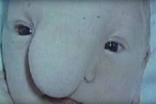 كرهته والدته بسبب بشاعته .. انظروا ماذا حدث بعد 44 سنة!