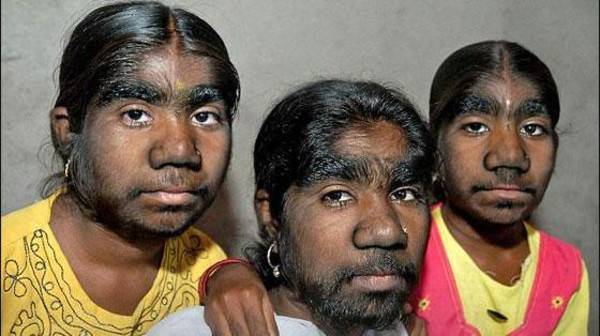 10 أمراض غامضة ونادرة.. هل سمعت بها؟ صور وفيديو