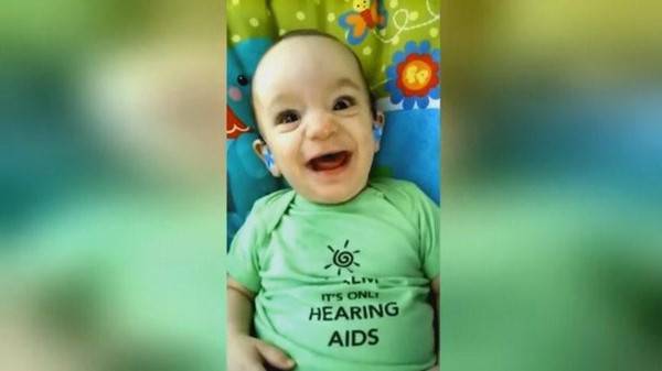 فيديو.. لحظة لا تتكرر.. عندما يسمع طفل أصم أمه لأول مرة