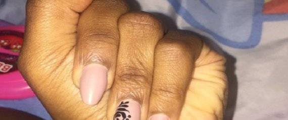 صورة غريبة ليد فتاة تثير الدهشة على تويتر.. فما قصتها؟