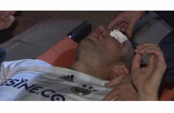 فان بيرسي يتعرض لإصابة خطيرة قد تفقده بصره (شاهد)