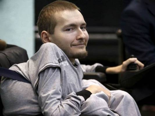 زراعة أول رأس في العالم.. هل تنجح ؟