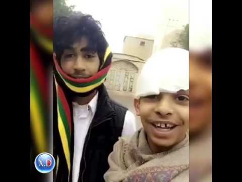 أبو سن أراد تجريب التفحيط فإنقلبت سيارته وفتح رأسه... فيديو