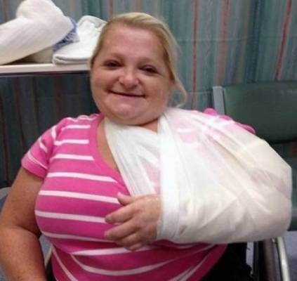 بالصور  سيدة تنكسر أضلاعها مع كل عطسة.. إليكم تفاصيل هذه الحالة النادرة!!