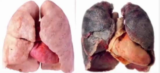 بالفيديو  تنظيف الرئة من النيكوتين خلال 72 ساعة بطريقة جديدة وبسيطة لن تتوقعها