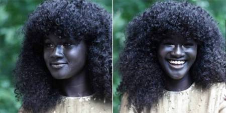 فيديو.. فتاة سمراء تبهر العالم بلون بشرتها النادر