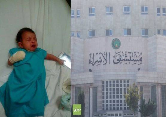 مستشفى الإسراء ينفي لـ(أخبار البلد) بتر أصبع طفلة..ويوضح الحقيقة