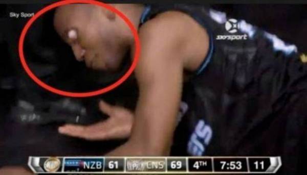 عين لاعب كرة سلة تخرج من محجرها أثناء مباراة لتعود في سيارة الإسعاف