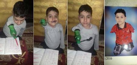 في مشهد مؤثر .. مصري يصنع طرفا صناعيا لابنه من قارورة بلاستيكية  فيديو