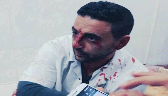 مجهولون يعتدون على طبيب أسنان بعيادته في الزرقاء