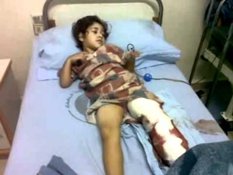 أمام وزير الصحة ..طفلة دخلت لتأخذ مطعوم زُكام  .. فخرجت (بلا قدم )!