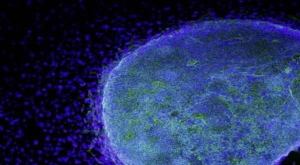 اكتشاف طريقة جديدة لعلاج السرطان