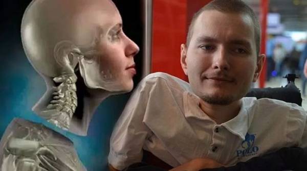 هل ستنجح أول جراحة في العالم لزراعة رأس كاملة؟