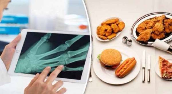 أطعمة قد تؤدي لمشاكل في المفاصل