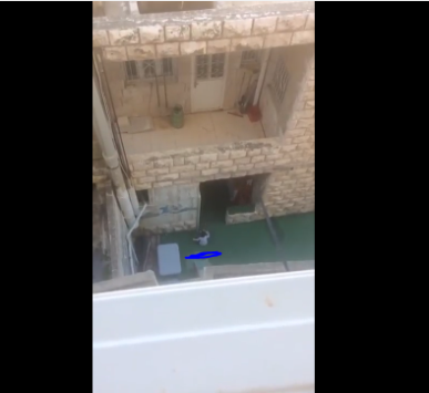 توجه لمقاضاة حضانة أساءت معاملة طفلة