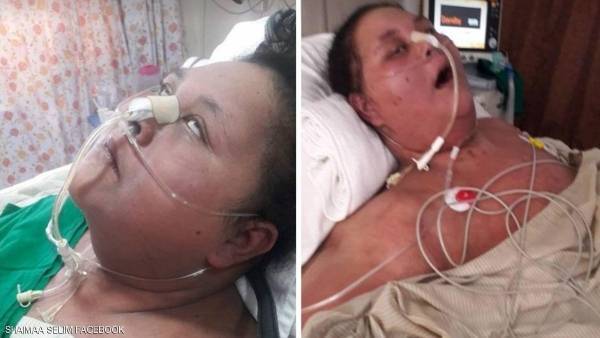 تحول خطير بحالة المصرية إيمان.. وأختها تتهم الطبيب بالخداع