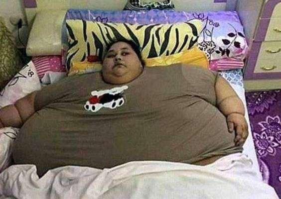 المستشفى التي تعالج أضخم امرأة في العالم تستدعي الشرطة لشقيقتها بعد أن كادت تقتلها