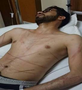 شاهد بالفيديو والصور .. الاعتداء على محام بعمان