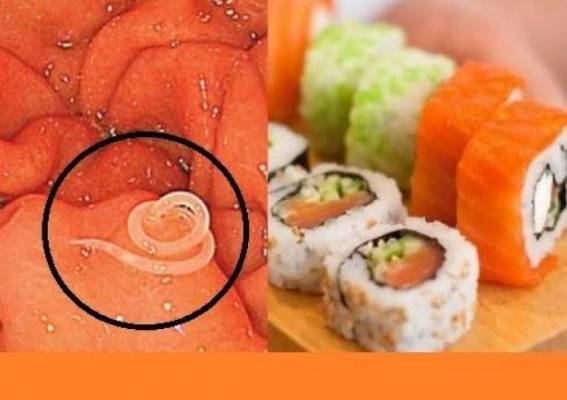 الدودة المدوّرة ستدخل أمعاءكم.. داء خطير ينقله السوشي ولا تعرفون