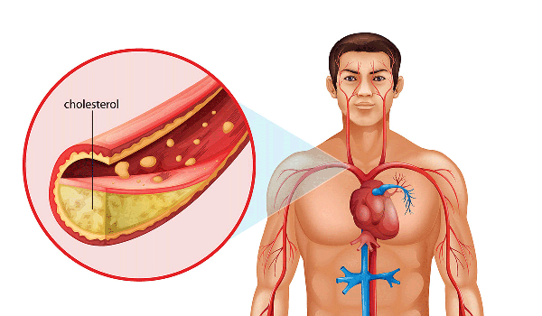 أطعمة تقلل الكوليسترول في الدم .. إليك 5 منهم اكتشفهم