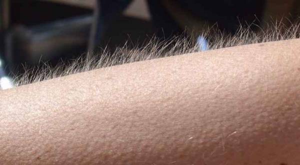 لماذا تقشعر أبداننا أحياناً عند سماع الموسيقى؟