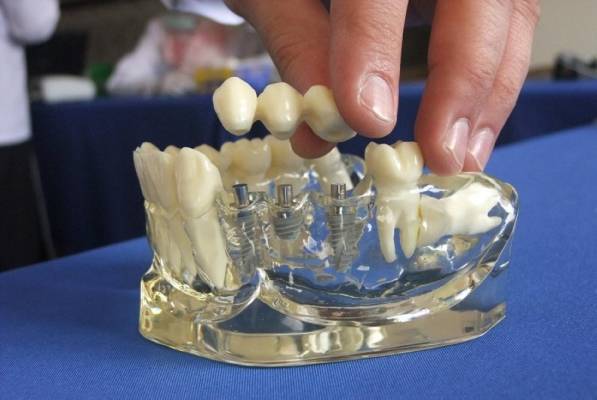 السماح بإنشاء كليات طب الاسنان في الخاصة بشروط إضافية