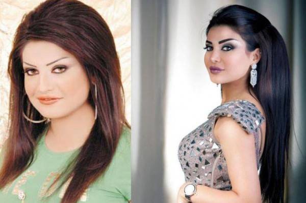 صور صادمة لنجمات الخليج قبل عملية رفع الحواجب