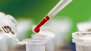 اختبار جديد يرصد انتشار الأورام السرطانية بقطرة دم