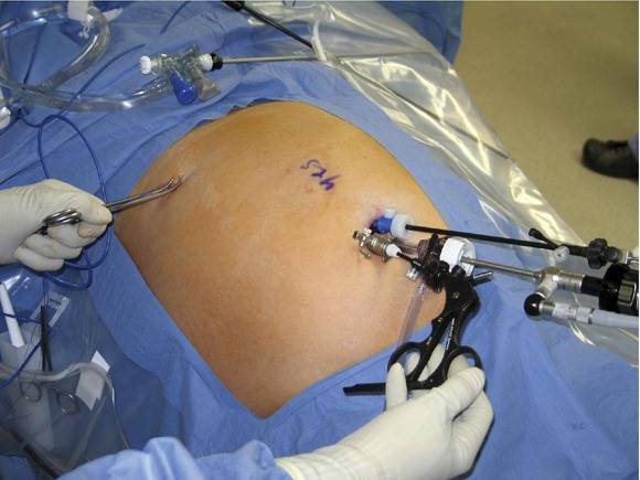 تمشياً مع سياسة القص .. شهبندر التجار يقص معدته