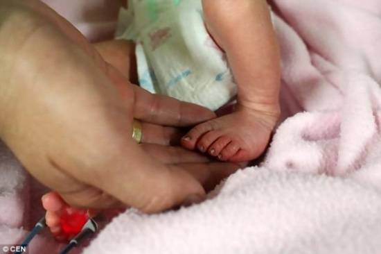 بالصور.. العثور على طفلة مغطاة بالنمل تخلت عنها والدتها